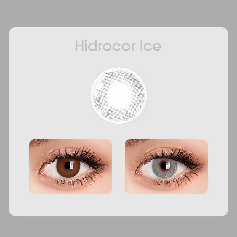 【Prescription】Mislens hidrocor Ice
