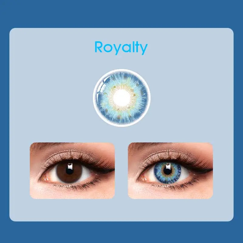 Mislens Rococo Royalty Blue